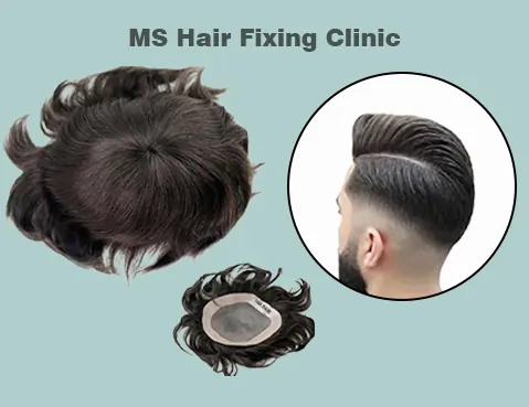 Customised hair patch & wig.webp